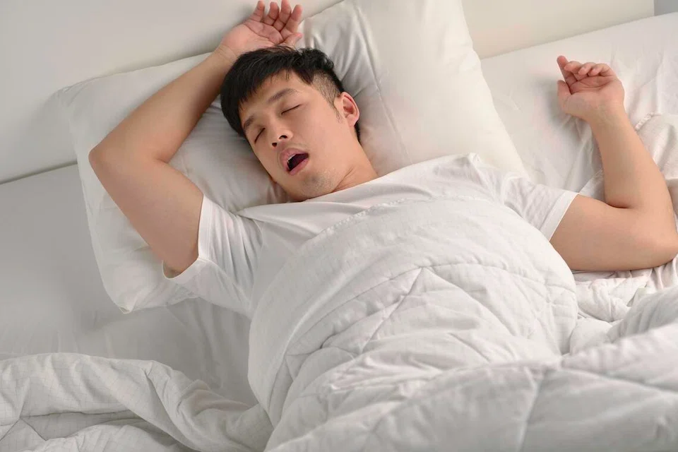 sleep apnea, pernafasan, dengkur