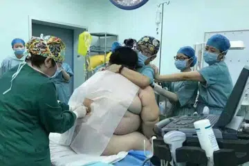 CABARAN BESAR: Seramai 16 kakitangan hospital diperlukan untuk membantu seorang wanita seberat kira-kira 140 kilogram melahirkan anak menerusi pembedahan Caesarean di sebuah hospital di Changsa, selatan China. - Foto HARIAN METRO