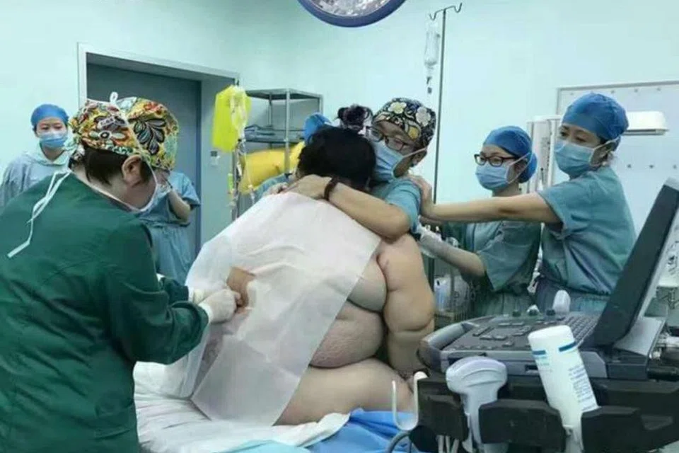 CABARAN BESAR: Seramai 16 kakitangan hospital diperlukan untuk membantu seorang wanita seberat kira-kira 140 kilogram melahirkan anak menerusi pembedahan Caesarean di sebuah hospital di Changsa, selatan China. - Foto HARIAN METRO