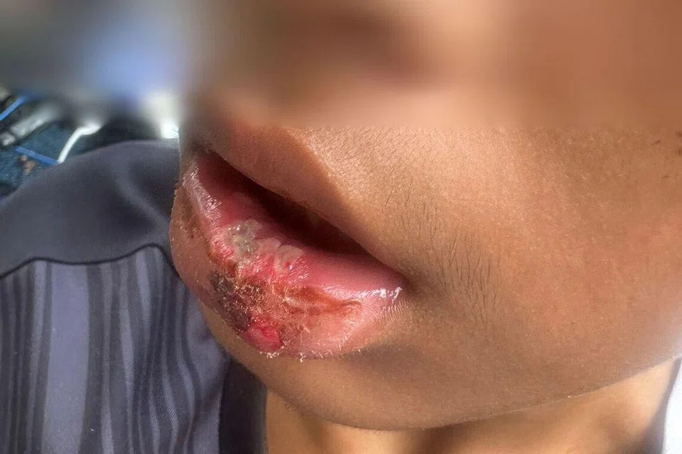 Cik Siti Zulaiha Karamda mendakwa anaknya (di dalam gambar) diserang pada Februari lalu.