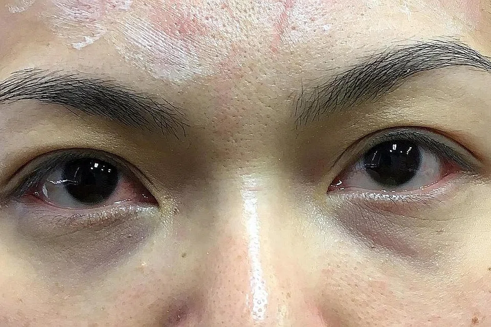 MENJADIKAN WAJAH LEBIH SEGAR DAN BERSIH: Dr Juliana menjalankan rawatan menghilangkan lingkaran hitam dan gelembung pada bawah mata seorang pesakit. 