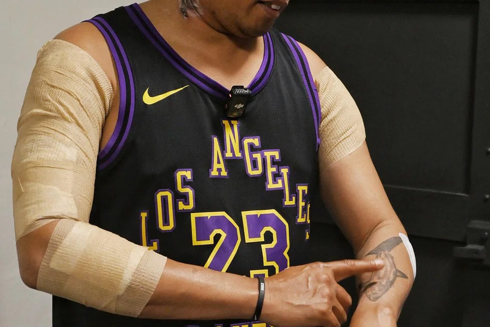 Encik Jojo Sanchez Arriesgado bertekad untuk menghapuskan tatu sebagai contoh teladan yang baik untuk anaknya yang baru lahir, agar tiada tanda tatu pada dirinya apabila anaknya membesar kelak.