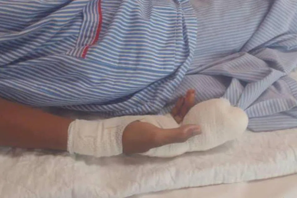 Seorang remaja lelaki berusia 14 tahun cedera dua jari kanan selepas tidak sempat melempar mercun bola dalam kejadian di Batu 23, Labok, Machang, Kelantan, pada 14 Mac lalu.