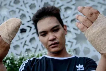 Encik Danial Radziman cedera di tangan akibat melecur susulan kebakaran saluran paip gas di Selangor berdekatan rumahnya. Beliau kini berlindung di pusat perlindungan sementara di Masjid Putra Heights.