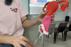 barah serviks, ujian swab