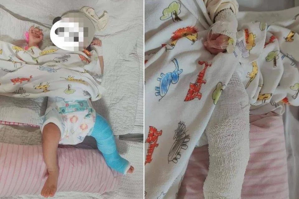 Bayi dua bulan patah kaki kiri disyaki didera pengasuh dalam satu kejadian di Bandar Dato’ Onn, Johor Bahru.