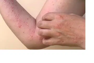 Foto hiasan