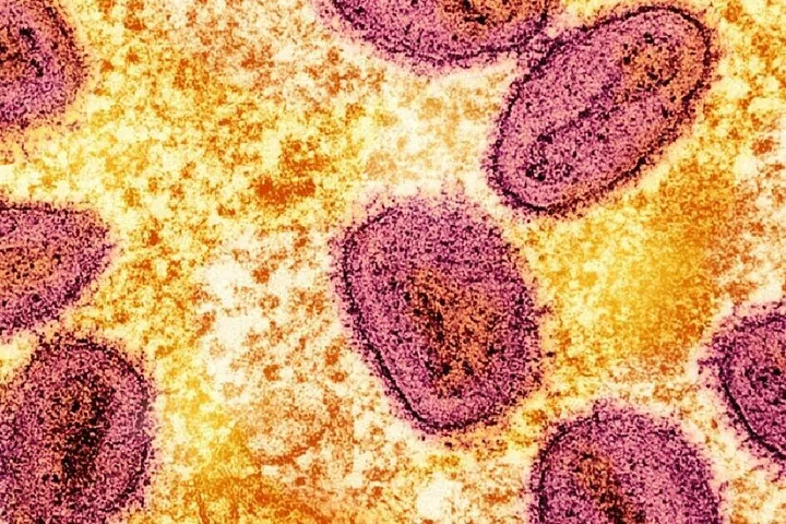 Mpox merupakan penyakit virus yang disebabkan oleh virus cacar monyet dan mempunyai dua varian (klad) berbeza. 
