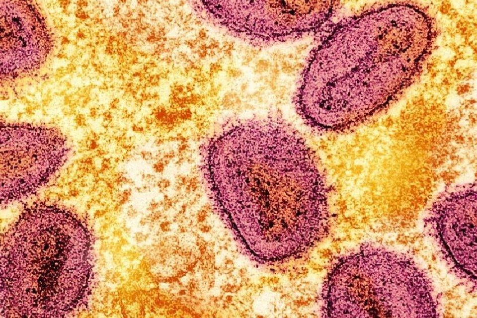 Mpox merupakan penyakit virus yang disebabkan oleh virus cacar monyet dan mempunyai dua varian (klad) berbeza. 