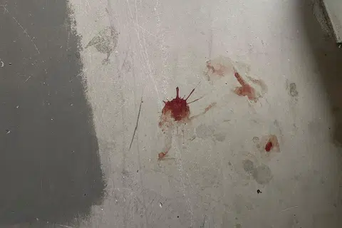 Menurut Cik Siti, anaknya diserang sehingga darah tertumpah di lantai di kawasan kejadian.