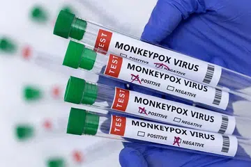 CACAR MONYET: MOH melaporkan dua lagi kes cacar monyet di Singapura.