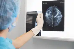 UJIAN MAMOGRAM: Seorang pakar perubatan memegang hasil ujian mamogram di hadapan iluminator x-ray. - Foto ISTOCKPHOTO