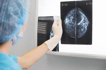 UJIAN MAMOGRAM: Seorang pakar perubatan memegang hasil ujian mamogram di hadapan iluminator x-ray. - Foto ISTOCKPHOTO