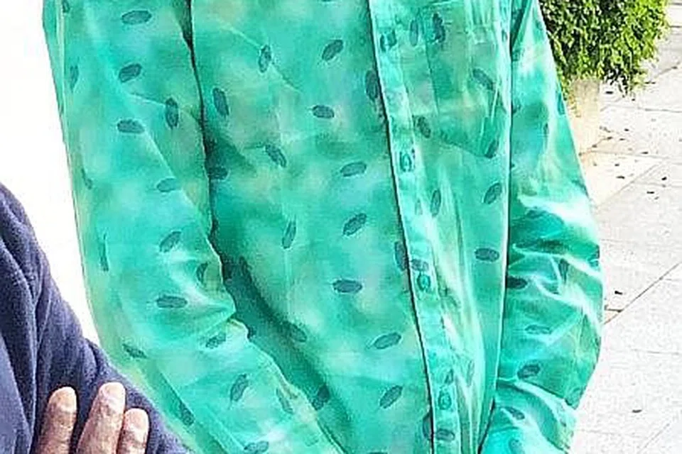 WAJAH BERPARUT: Parut pada muka Encik Hossain Jitu, akibat kelecuran yang dialaminya dalam kebakaran di bengkel tempat kerjanya di Tuas Avenue 11 pada 24 Februari lalu, jelas kelihatan di balik pelitup yang dipakai beliau.
