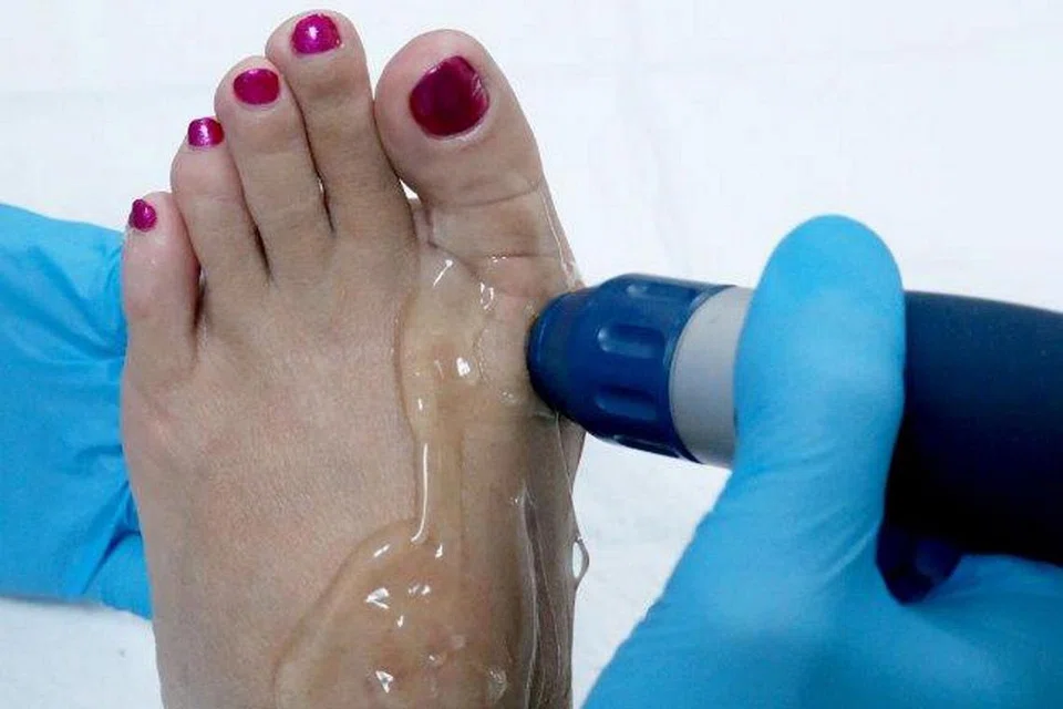 MASALAH KETURUNAN: Seperti ibu dan adik perempuannya, Cik G. Wong juga mempunyai masalah 'bunion' iaitu ketumbuhan kulit keras yang menyelaputi tulang metatarsus pertama dan ibu jari kaki, kulit gatal dan sakit di bahagian depan kaki yang kelihatan lebih lebar daripada biasa.