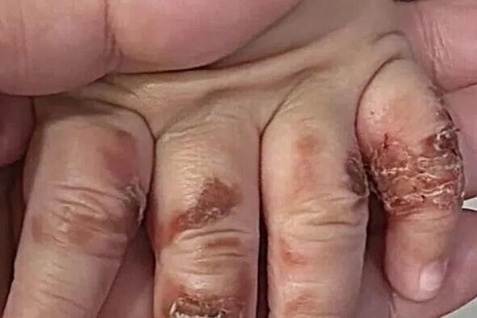 Bayi 15 bulan dicubit, ditendang dan dicampak tanpa pengetahuan keluarga.