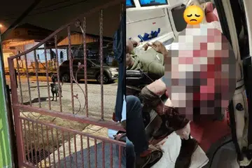 Dua ekor anjing jenis Rottweiler yang menyerang lima mangsa di Baling, Kedah (kiri) dan gambar salah seorang daripada lima mangsa mendapatkan rawatan. 