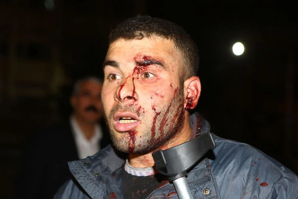 ANTARA YANG CEDERA: Seorang lelaki berlumuran darah selepas letupan kuat menggegarkan Ankara. -- Foto AFP