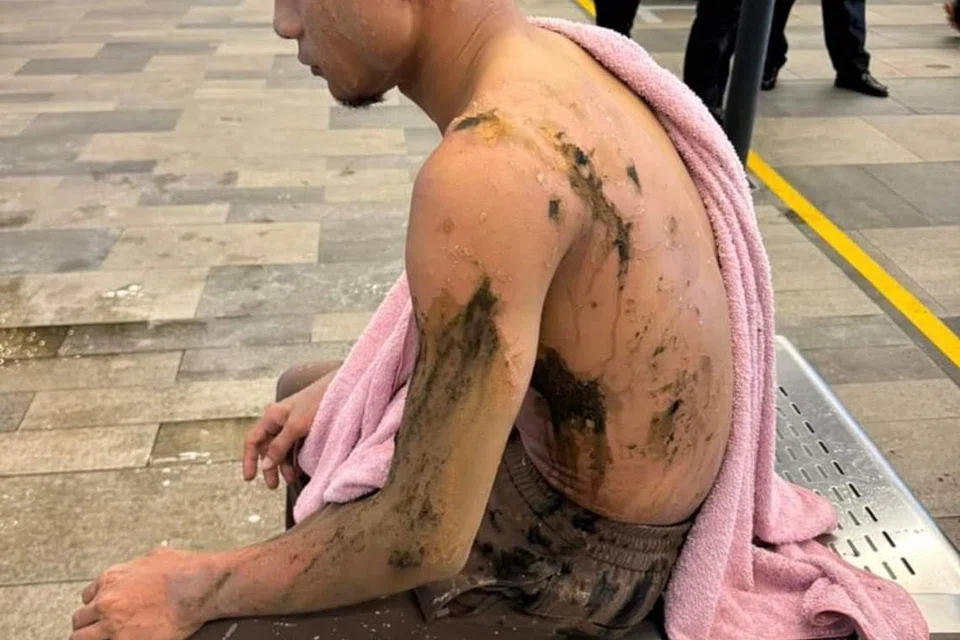 Beginilah keadaan pemain Selangor FC dan pemain kebangsaan Malaysia, Faisal Halim yang disimbah asid di sebuah pusat beli belah di Damansara pada 5 Mei. 