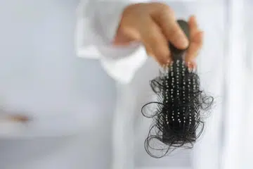 rambut tipis, berusia, rawatan kulit  