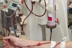 Masalah kulit gatal lazim berlaku kepada pesakit ginjal yang menjalani dialisis. Masalah kulit gatal boleh berlaku atas pelbagai faktor, antaranya ialah masalah keradangan, kulit yang kering atau alahan. 