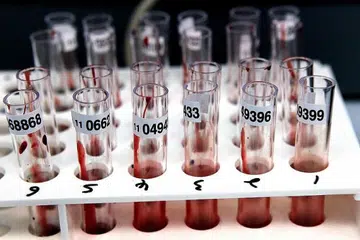 KEBOCORAN MAKLUMAT SULIT: Nama dan maklumat 14,200 warga setempat dan asing yang terdapat dalam Data Pendaftaran HIV telah dicuri daripada Kementerian Kesihatan antara Mac 2012 dengan Mei 2016. - Foto fail