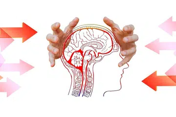 Ilustrasi penyakit migrain