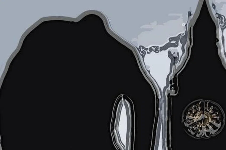 Fallback image