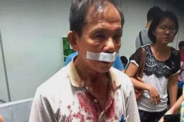Encik Khoo menerima 20 jahitan di bibir dek dikatakan ditumbuk pemandu kereta yang tidak sempat berhenti lalu merempuh bahagian belakang keretanya. 