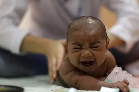 PELBAGAI MASALAH KESIHATAN: Rafael, bayi yang menghidap penyakit microcephaly, yang dipercayai akibat virus Zika, menjalani pemeriksaan di pusat pemulihan Altino Ventura, Recife, Brazil. - Foto REUTERS