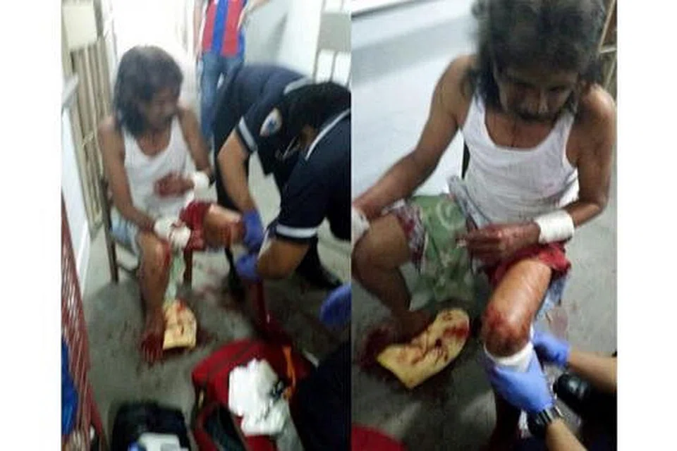 DISERANG KETIKA MEMBAIKI BASIKAL: Encik Abdul Majid cedera akibat diserang lelaki yang dikenali sebagai 'Gemuk'. - Foto WANBAO