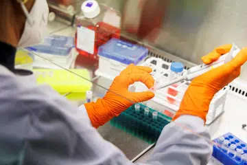 Demi membantu usaha menangani wabak mpox, Kementerian Kesihatan (MOH) Singapura menyumbang peralatan yang membolehkan Pusat Kawalan dan Pencegahan Penyakit Afrika (CDC Afrika) untuk menjalankan 50,000 ujian.   