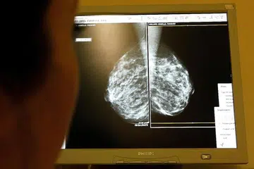 UJIAN MAMOGRAM: Matlamat pemeriksaan mamogram adalah untuk mengesan barah pada peringkat awal, apabila tumor masih kecil. Wanita berusia 40 tahun ke atas pula harus menjalani pemeriksaan mamogram pada setiap tahun, manakala mereka berusia 50 tahun ke atas harus melakukan pemeriksaan mamogram pada setiap dua tahun sekali. - Foto hiasan