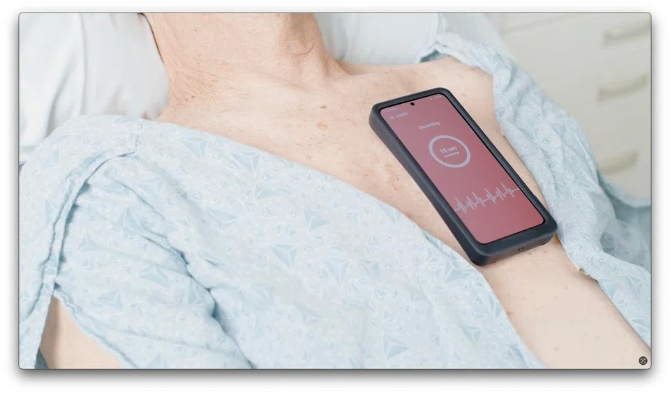 Peranti penderiaan tekanan jantung dan paru-paru bukan invasif, iaitu peranti Acorai, berpotensi mengubah cara pesakit kegagalan jantung dipantau dan dirawat.