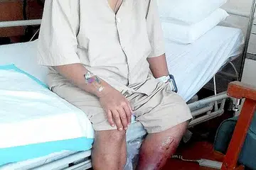 PASRAH DENGAN KEADAAN: Alias Kadir menantikan dengan sedih detik sebelum pembedahan ke atas kakinya di NUH semalam. - Foto ihsan KELUARGA ALIAS KADIR