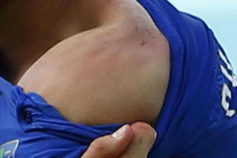 BUKTI KESALAHAN SUAREZ?: Pemain bek Italy, Giorgio Chiellini, menunjukkan bekas gigitan Luis Suarez di bahu kirinya dalam insiden dalam kotak penalti Italy pada minit ke-80. - Foto REUTERS