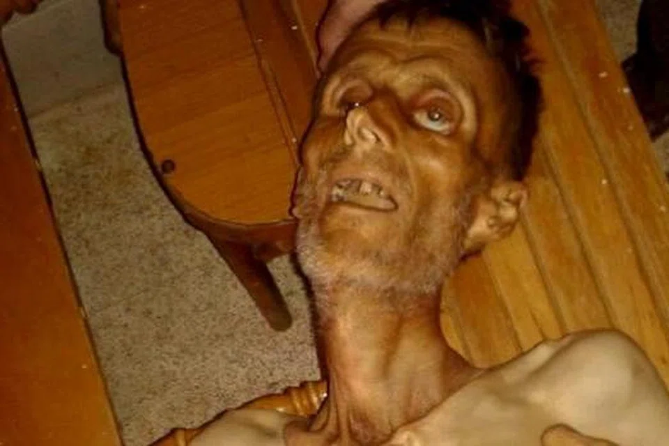 Seorang lelaki kurus kering tidak bermaya di Madaya dipapar dalam gambar tidak bertarikh yang diambil dariPADA media sosial ini. Gambar REUTERS
