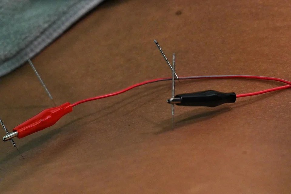 ELEKTROAKUPUNKTUR: Dalam rawatan elektroakupunktur, arus elektrik kecil mengalir di antara sepasang jarum akupunktur. Amalan ini dipercayai dapat menambahkan keberkesanan penggunaan akupunktur biasa, dan boleh memulihkan kesihatan dan kesejahteraan serta merawat kesakitan.
