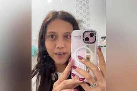 Pengguna TikTok yang dikenali sebagai ‘Azula Cinta’, dilihat menerusi tangkap layar dari siaran TikTok, berkata beliau merasa pedih di kedua-dua belah matanya selepas beberapa jam memakai kanta lekap yang dibeli dari dalam talian.