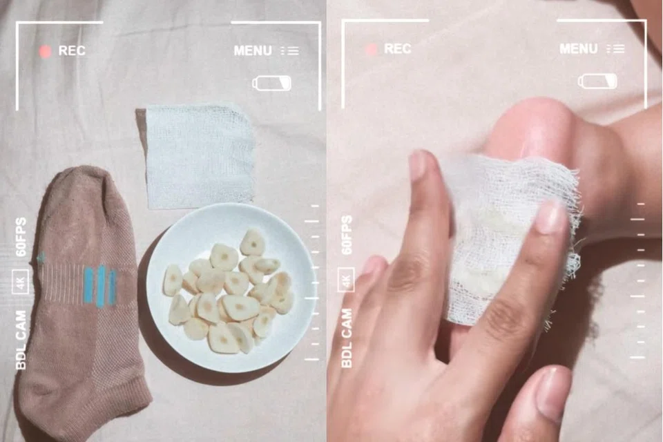 KONGSI TIP: Dalam video 32 saat yang dimuat naik Instagram, beberapa kepingan bawang putih dibalut  menggunakan kain kasa.