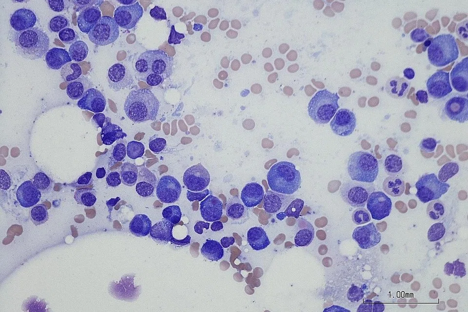 BAKTERIA JAHAT LAWAN BAKTERIA BAIK: Bakteria usus terdiri daripada bakteria baik dan bakteria jahat. Kandungan bakteria-bakteria ini perlulah seimbang untuk memastikan sistem penghadaman berjalan lancar dan menggalakkan penyerapan nutrien yang lebih berkesan. - Foto ISTOCKPHOTO