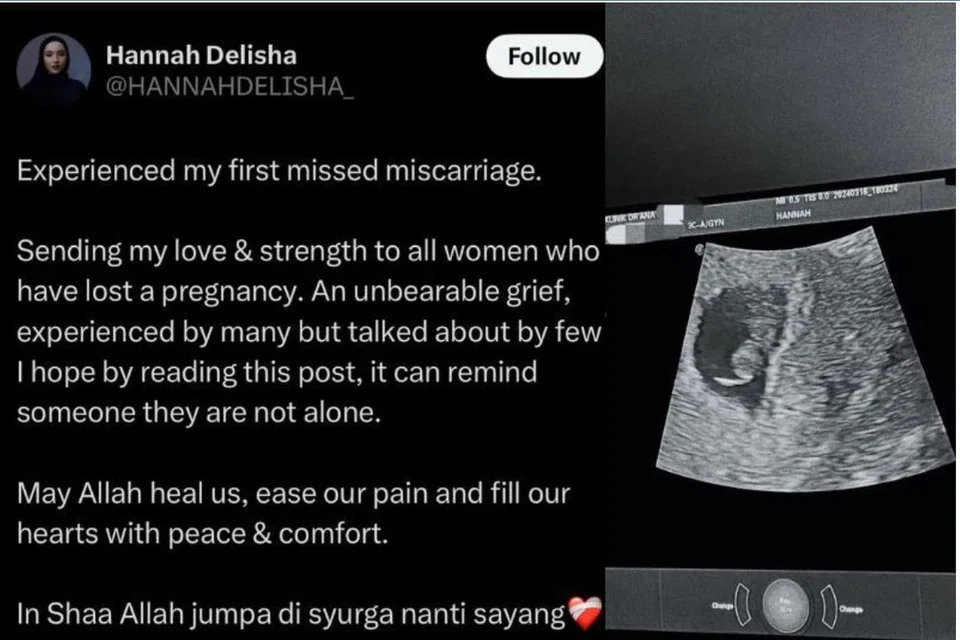 Hannah Delisha memuat naik pengumuman sedih keguguran anak yang dikandung selama tiga bulan.