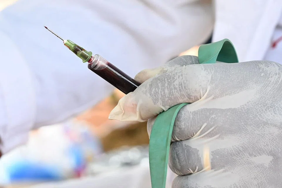 Pelan masyarakat henti penyebaran HIV dan Aids jelang 2030 di Singapura dilancar