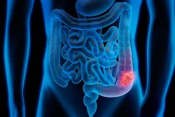 RAHSIAKAN PENYAKIT: Chadwick Boseman, pelakon yang memegang watak Black Panther, merahsiakan penyakit barah kolon yang dikesan pada 2016, hinggalah beliau meninggal dunia Ogos lalu. - Foto hiasan ISTOCKPHOTO 