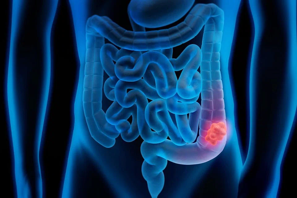 RAHSIAKAN PENYAKIT: Chadwick Boseman, pelakon yang memegang watak Black Panther, merahsiakan penyakit barah kolon yang dikesan pada 2016, hinggalah beliau meninggal dunia Ogos lalu. - Foto hiasan ISTOCKPHOTO 