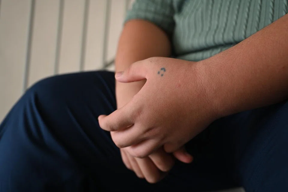 Razali (bukan nama sebenar) tidak sedar tatu yang hanya dibuat menggunakan dakwat pena akan menjadi kekal, dan beliau terpaksa menjalani beberapa sesi rawatan laser di klinik untuk membuangnya. 