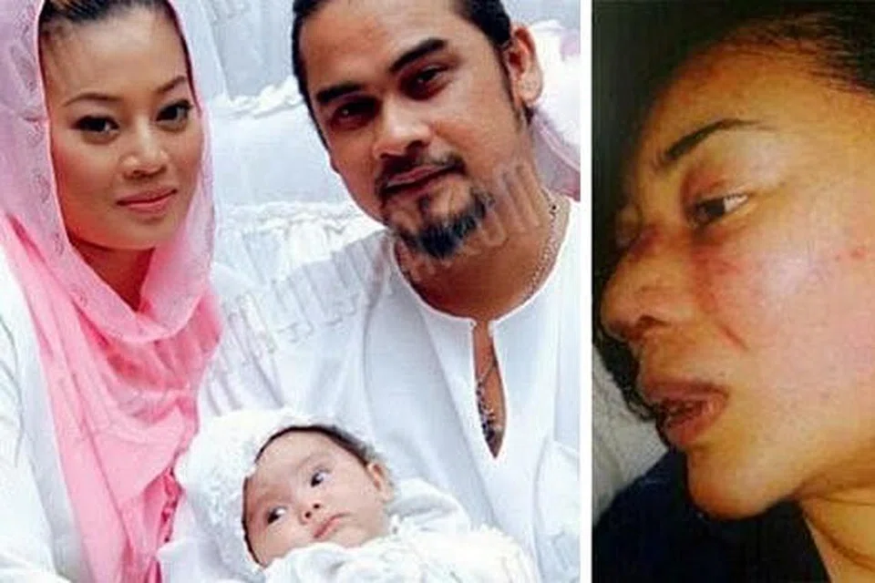 AMANDA MISBUN APA DAH JADI?: Awie (foto atas, kiri bersama isteri, Rozana Misbun dan anak mereka) didakwa memukul dan mencederakan Rozana dan kini disiasat. (Kanan) Foto wanita yang cedera wajahnya dan didakwa sebagai Rozana tersebar di Internet. - Foto-foto ROTI KAYA