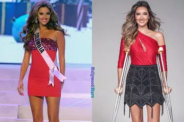 TETAP POSITIF: Kaki kiri Cik Daniella Alvarez, 32 tahun, dari Barranquilla, Colombia, yang dinobatkan sebagai Miss Colombia pada 2011 dan seterusnya mewakili negaranya di Miss Universe 2012, telah dipotong berikutan komplikasi pembedahan. 