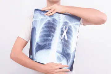 IMBASAN PERCUMA: Program imbasan peparu percuma yang pertama di Singapura bagi keluarga berpendapatan rendah kini sedang berlangsung sehingga 18 Ogos.