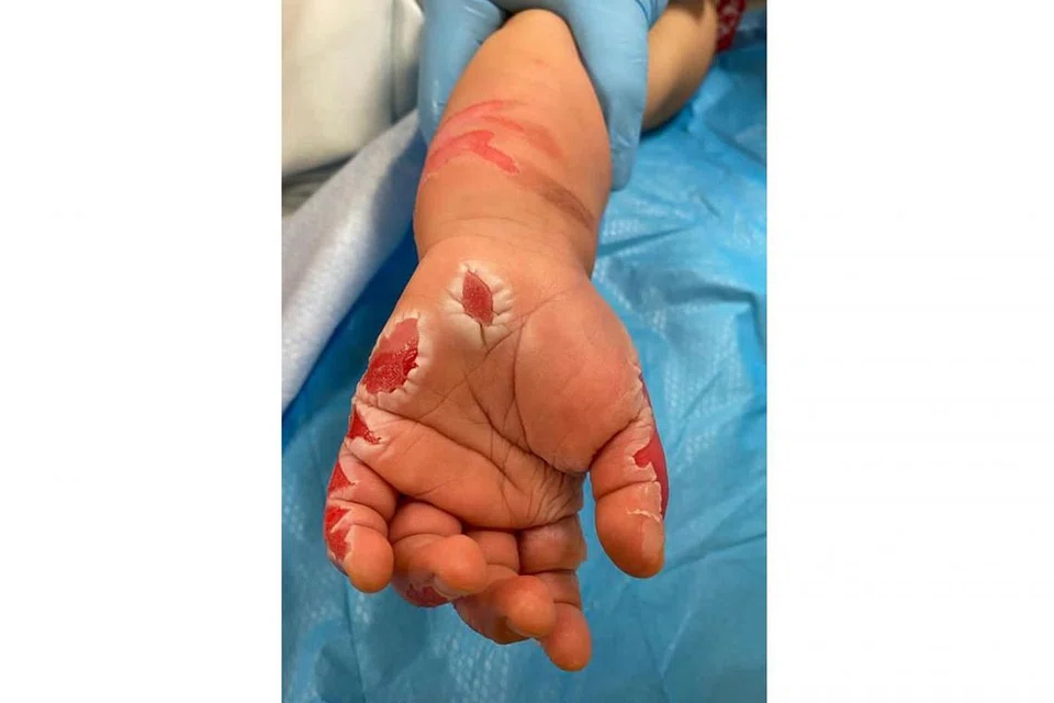 VIDEO JADI BUKTI: Pembantu rumah terlibat pada mulanya mendakwa bayi itu tersentuh periuk yang sedang memasak. Bagaimanapun, selepas melihat rakaman video, dia berkata dia menyakiti anak itu agar dia boleh pulang ke rumah. - Foto-foto AMY LOW MEI LIANG / FACEBOOK